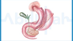 Gastrik Bypass Ameliyatı: Yeni Bir Başlangıç İçin Cesaret Veren Adım