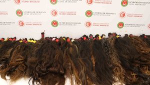 Milyonluk gerçek insan saçı operasyonu