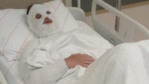 Eski nişanlısına kimyasal sıvı atan kişiye 15 yıl hapis cezası