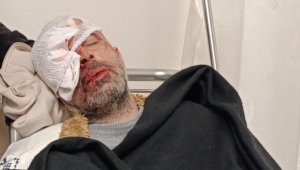 Köpeklerden kaçarken bisikletten düşüp, yaralandı