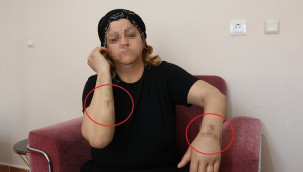 30 yerinden bıçaklandı