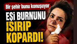 Eşi burnunu ısırıp kopardı!
